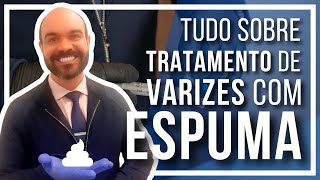 🔴Tudo sobre Tratamento de Varizes com ESPUMA Varizes grossas sem Cirurgia [upl. by Nike]