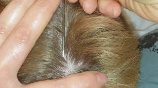 Read description no talking 1st 8 min ASMR dandruff rat tail amp lice combs scalp scratching picking [upl. by Leimaj]