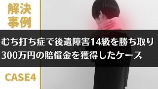 【交通事故 解決事例CASE4】むち打ち症で後遺障害14級を勝ち取り、300万円の賠償金を獲得したケース [upl. by Xed434]