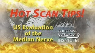 Hot Tips  Ultrasound Evaluation of the Median Nerve [upl. by Aierb]