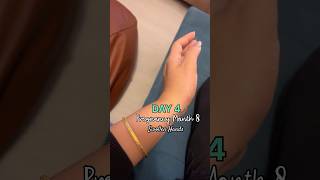 Pregnancy Vlog  Feeling tired amp Hands Swollen 🥴 pregnancyjourney minivlog pregnancysymptoms [upl. by Verneuil773]