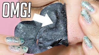 CRAZY BLACKHEAD TRICK Baking Soda  Pore Strip [upl. by Reizarf]