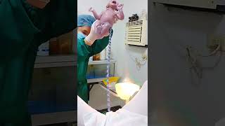 Baby with Umbilical cord 💗♥️❤️💓 chandututorialeducation pregnancy ivfbabies 💓❤️💗❣️💕💕🥰 [upl. by Arytal]