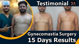 15 Days Post Gynecomastia Surgery [upl. by Bonni]