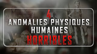 4 ANOMALIES PHYSIQUES HORRIBLES [upl. by Bannister512]