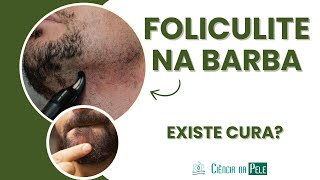 Foliculite na Barba Causas e Tratamentos Específicos para Homens [upl. by Acinorav]