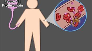 Treating Hemophilia A [upl. by Ilbert]