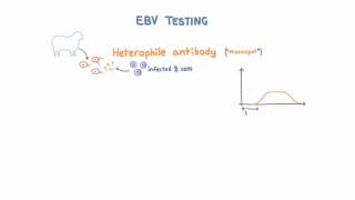 Epstein Barr Virus EBV Diagnosis and Testing [upl. by Bain]