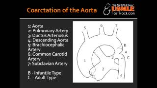 Coarctation of the Aorta  Infantile type amp Adult type [upl. by Yrrag]