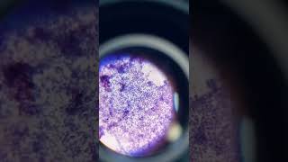 Gram positive cocci [upl. by Eiramanitsirhc496]