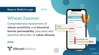 Vibrants Wheat Zoomer  Report Walkthrough [upl. by Bogart]