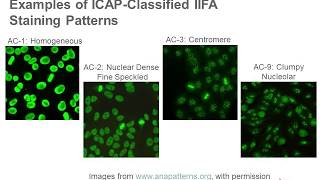 Antinuclear Antibody Testing [upl. by Romelda]