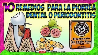 10 Remedios Caseros para la Piorrea Dental o Periodontitis  Como Tratar Curar Periodontitis🚩🚩 [upl. by Anhaj]