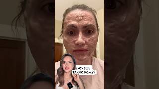 ❌ЗОМБИ МАСКА ОТ ЧЕРНЫХ ТОЧЕК И МОРЩИН😱маскаотморщин маскаотпрыщей маскадлялица кремдлялица [upl. by Ynnelg987]