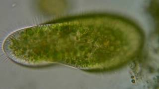 04 Paramecium bursaria com algas endossimbiontes [upl. by Gallard41]