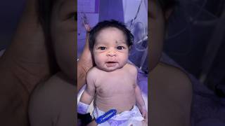 Bigg eyes baby in nicu  newbornbaby youtubeshorts babydocter newdoctor baby cute newborn [upl. by Allebram]