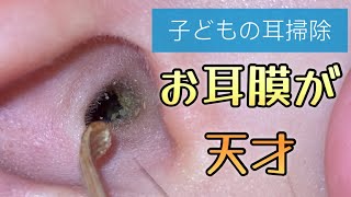 子どもの耳掃除 お耳膜のファーストインパクト👂 [upl. by Desberg779]