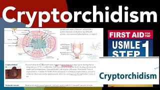 Cryptorchidism in HindiUrdu by first aid for USMLE step 1 [upl. by Darrey882]