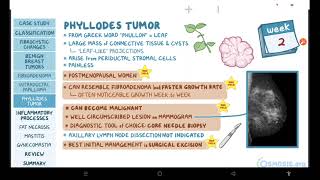 Benign breast conditions  pathology review  Osmosis [upl. by Kariv]