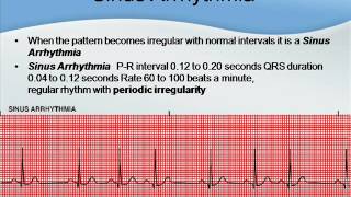 NCLEX Tutor EKG strips for the NCLEX amp beginners [upl. by Kinghorn810]