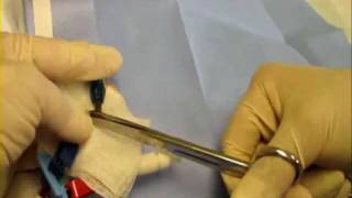 Tunelled central venous dialysis catheter Permacath repair [upl. by Llednov]