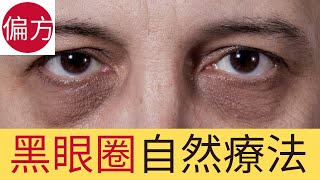 黑眼圈自然療法｜徹底改善三招 [upl. by Aiekat]