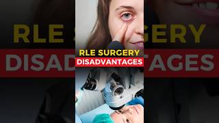 RLE Surgery Disadvantages [upl. by Eibob129]