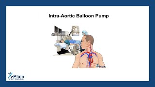 IntraAortic Balloon Pump [upl. by Ellen]