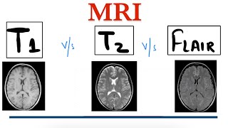 T1 MRI vs T2 MRI vs FLAIR MRI  MRI Brain  Radiology [upl. by Tteraj]