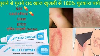 acid chryso acid chryso cream acid chryso homeopathic medicine acid chryso cream uses in hindi a [upl. by Desiree686]