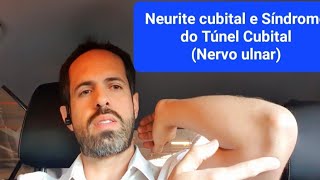 5 Dicas Tratamento da Neurite Cubital  Nervo Ulnar [upl. by Llertnahs141]