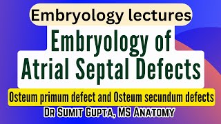 Atrial Septal Defects  Embryological basis [upl. by Llemrej]