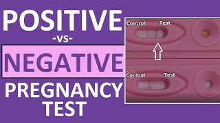 How to take pregnancy test at home Right method  ಮನೆಯಲ್ಲೇ pregnancy ಟೆಸ್ಟ್ ಮಾಡೋದು ಹೇಗೆ [upl. by Witte]