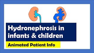 Hydronephrosis Explained Animated Patient Info [upl. by Verna255]