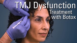 TMJ Dysfunction Treatment with Botox®  Sneak Preview [upl. by Ahseekal]