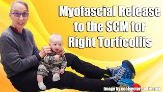 Gentle Sternocleidomastoid Myofascial Release RightSided Torticollis Treatment in Babies 042R [upl. by Edieh]