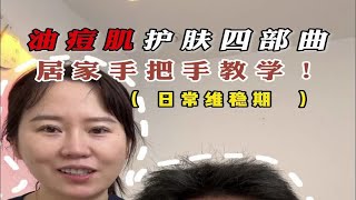 油痘肌痘痘干掉以后，教会你后续怎么护肤维稳不长闭口 [upl. by Fauman]