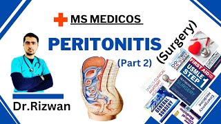 Peritonitis Part 2SurgeryMS MedicosDr RizwanUrdu Hindi Easy Explanations [upl. by Elfont]