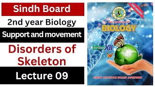 disorders of skeleton  support and movement  class 12 biology Sindh board New book [upl. by Alidus]