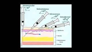 intermuscularhospital view viralvideo youtubetrending medicalstudent [upl. by Nnylharas]