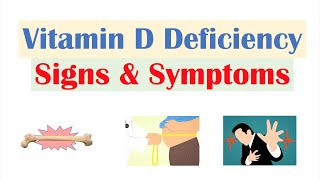 Vitamin D Deficiency Signs amp Symptoms ex Fatigue Diagnosis Treatment [upl. by Amikehs235]