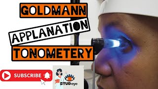 Goldmann Applanation Tonometer  Tonometry [upl. by Isabel548]