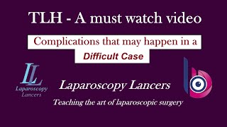 Difficult TLH  A must see surgery for all gynaecologists and surgeons [upl. by Esinahs]