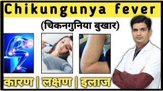 Chikungunia treatment  Chikungunya joint pain treatment hindi chikungunya [upl. by Akisej353]