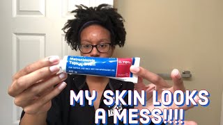 Skin Vlog I have a Perioral Dermatitis and Acne I was Prescribed Doxycycline amp Metronidazole Cream [upl. by Bibbie]