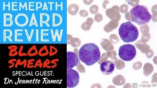 Hemepath amp Hematology Board Review Peripheral Blood Smears with Dr Jeanette Ramos [upl. by Alleon645]