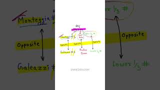 Galeazzi fracture enmeder [upl. by Gokey]