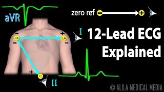 12 Lead ECG Explained Animation [upl. by Kilby717]