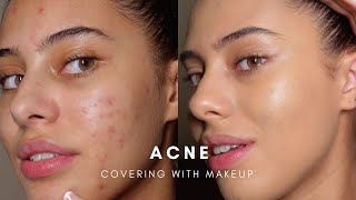 HOW TO COVER ACNE WITH MAKEUP BASE ROUTINE [upl. by Mylander]