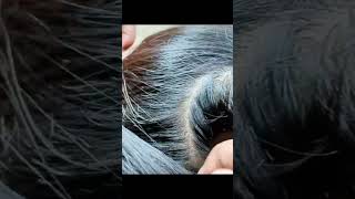 ASMR LICE lice hair headlice liceremoval hairstyle [upl. by Marji582]